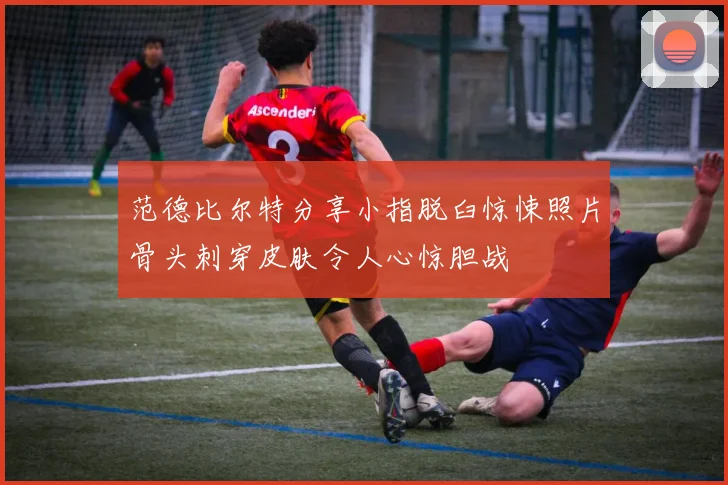 范德比尔特分享小指脱臼惊悚照片骨头刺穿皮肤令人心惊胆战